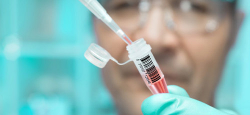 Snellere servers helpen medisch onderzoek